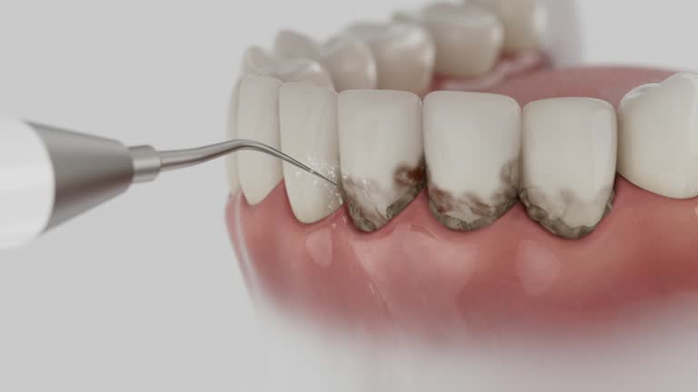 Reliable Dental Implants contractor in Humphreys County County, MS by Dentist Open Now